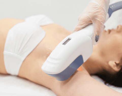 laser hair removal tampa cost